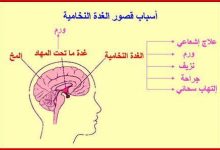 قصور الغدة النخامية