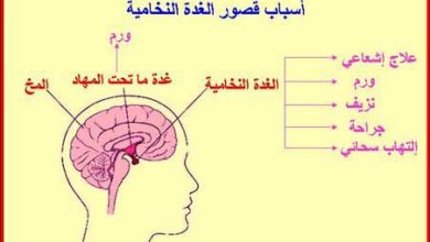 قصور الغدة النخامية