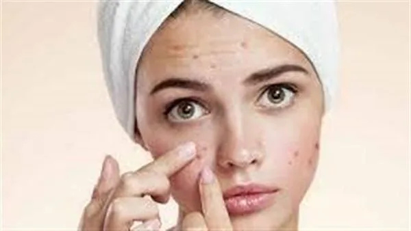 أسباب غير متوقعة لظهور البثور