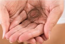 تساقط الشعر