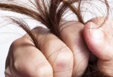 نصائح لعلاج تقصف الشعر