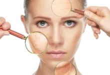 مشاكل البشرة أثناء فصل الصيف