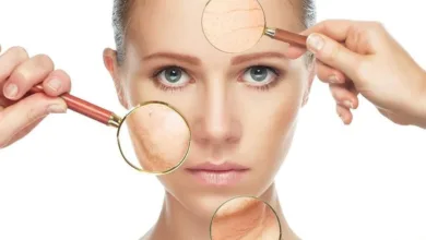 مشاكل البشرة أثناء فصل الصيف