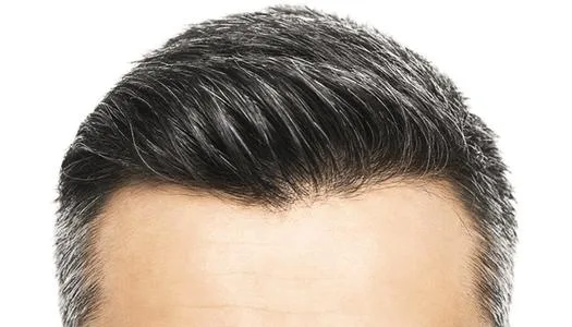 الشعر الأبيض