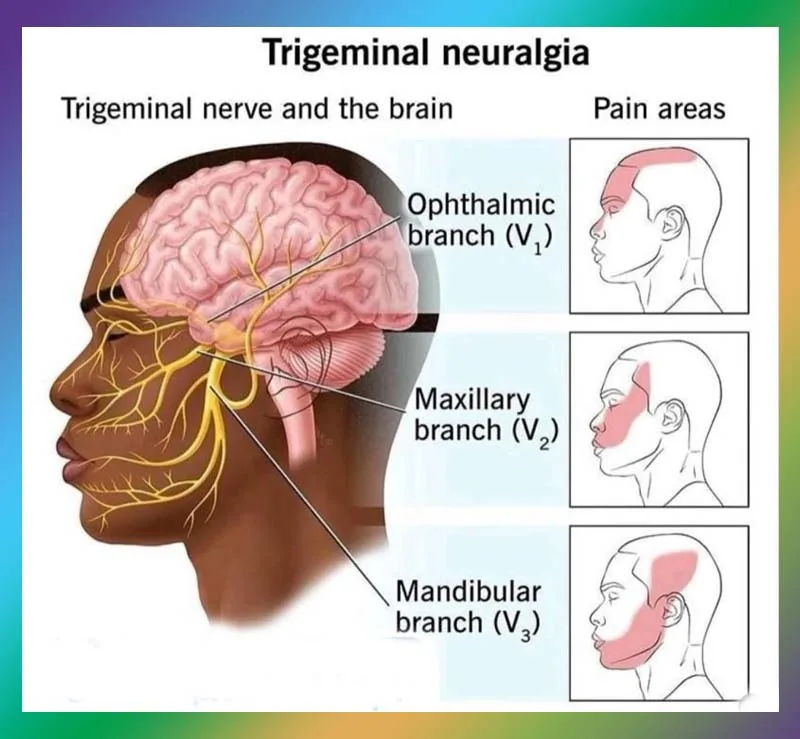 فروع العصب الخامس